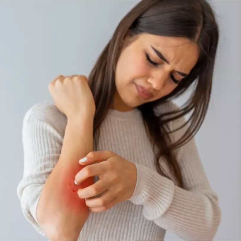 Az Allegra® segít a bőrallergia tüneteinek enyhítésében